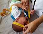 Brasil adota parâmetro da OMS e reduz medida para microcefalia