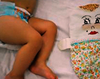 Saúde divulga diretriz nacional para estimulação precoce de bebês com microcefalia